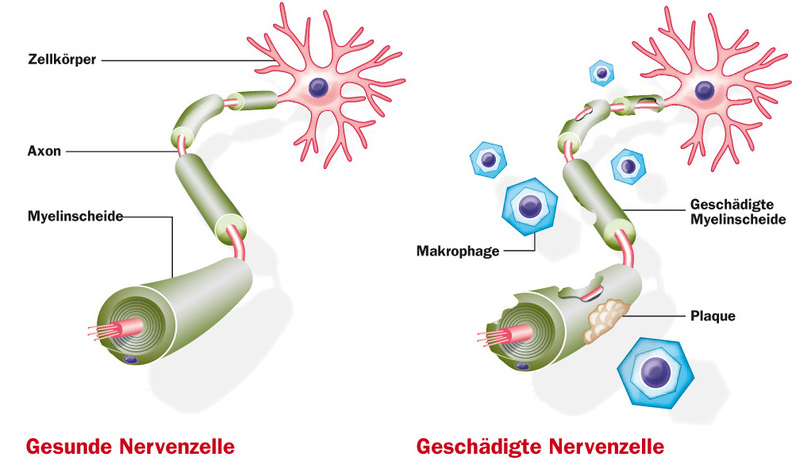 Aufbau der Nervenfaser einer Nervenzelle